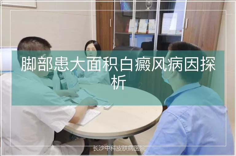 脚部患大面积白癜风病因探析