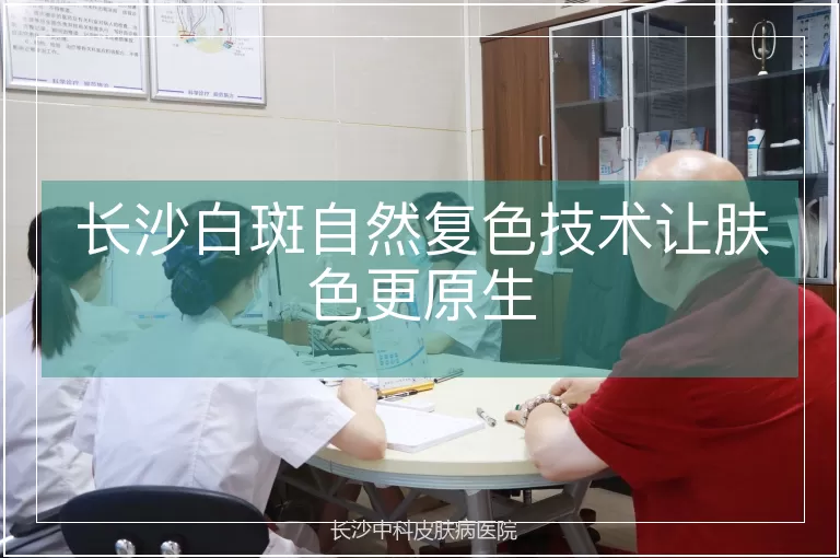 长沙白斑自然复色技术让肤色更原生