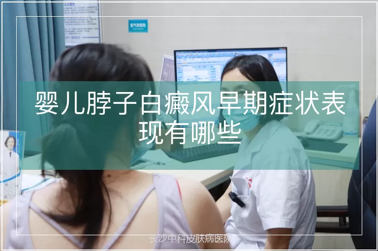 婴儿脖子白癜风早期症状表现有哪些