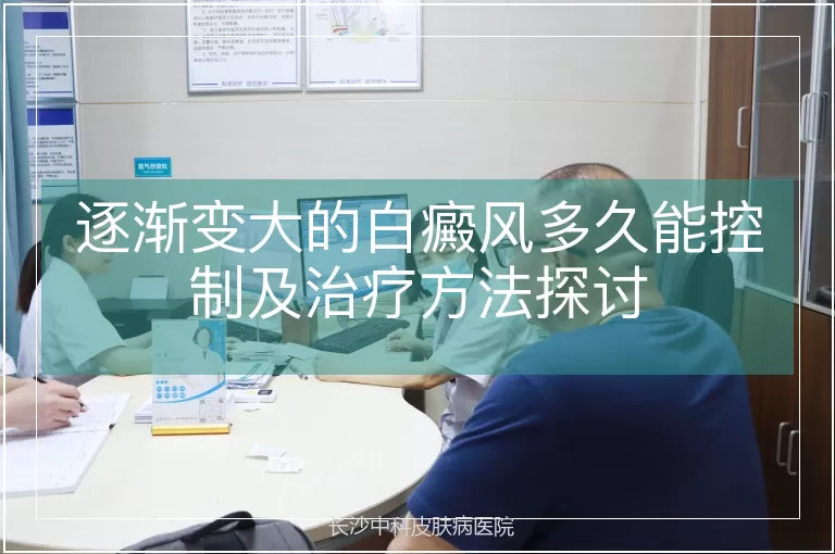 逐渐变大的白癜风多久能控制及治疗方法探讨