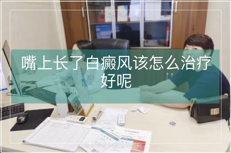 嘴上长了白癜风该怎么治疗好呢