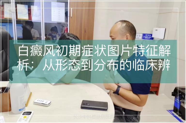 白癜风初期症状图片特征解析：从形态到分布的临床辨识要点