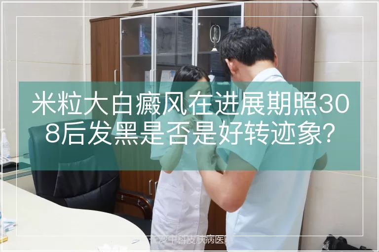 米粒大白癜风在进展期照308后发黑是否是好转迹象？