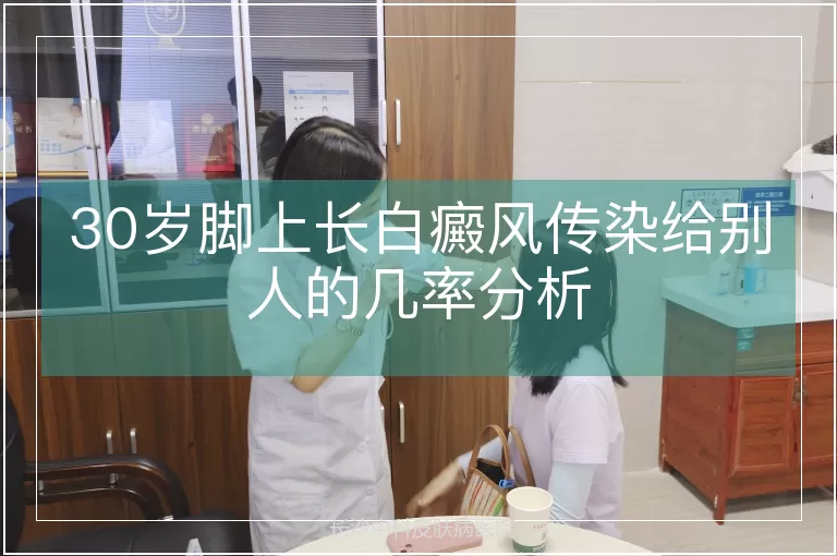 30岁脚上长白癜风传染给别人的几率分析