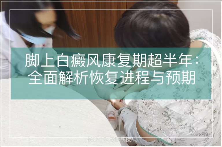 脚上白癜风康复期超半年：全面解析恢复进程与预期