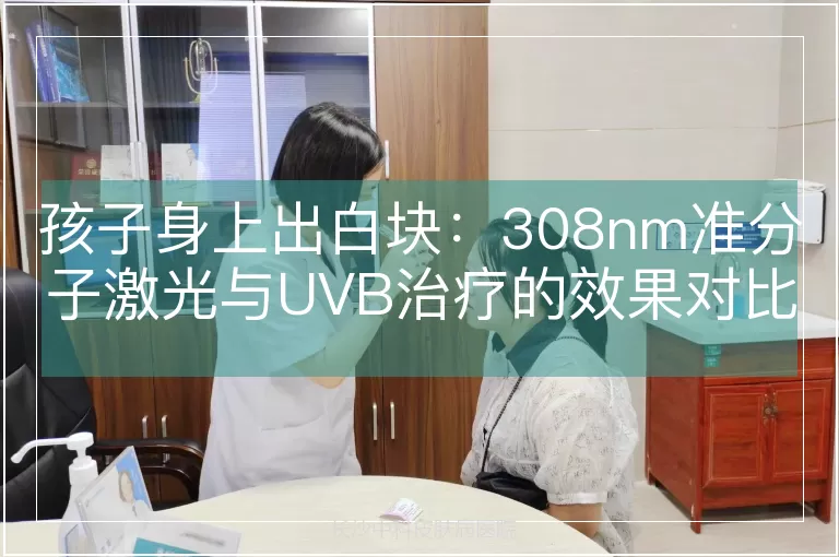 孩子身上出白块：308nm准分子激光与UVB治疗的效果对比