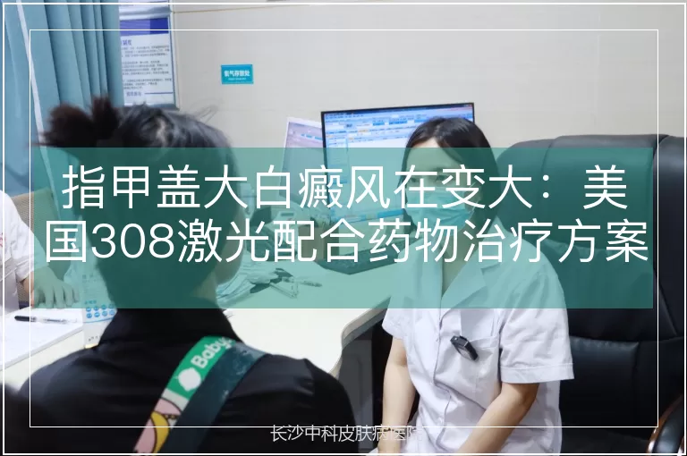 指甲盖大白癜风在变大：美国308激光配合药物治疗方案探讨