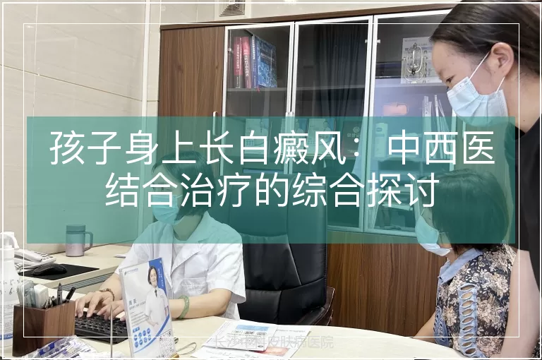 孩子身上长白癜风：中西医结合治疗的综合探讨
