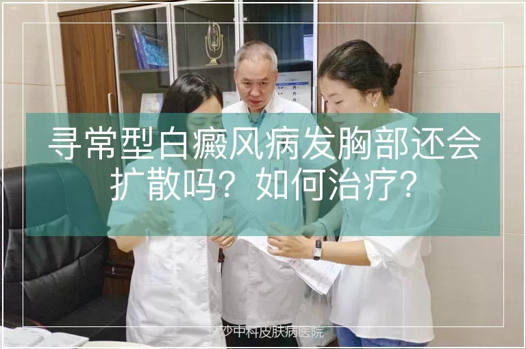 寻常型白癜风病发胸部还会扩散吗？如何治疗？