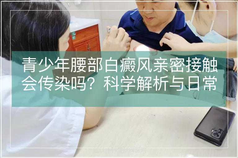 青少年腰部白癜风亲密接触会传染吗？科学解析与日常防护指南
