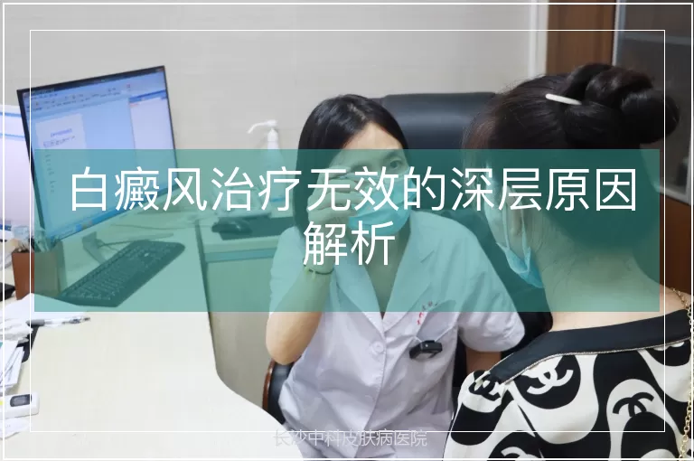 白癜风治疗无效的深层原因解析