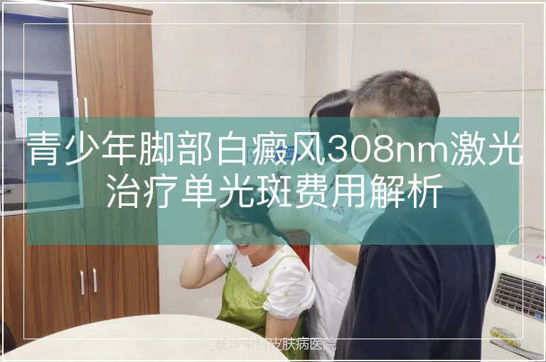 青少年脚部白癜风308nm激光治疗单光斑费用解析