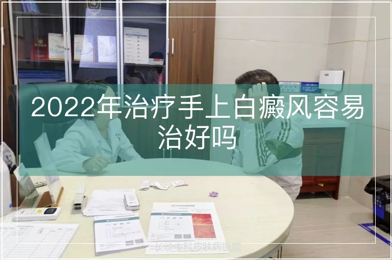 2022年治疗手上白癜风容易治好吗