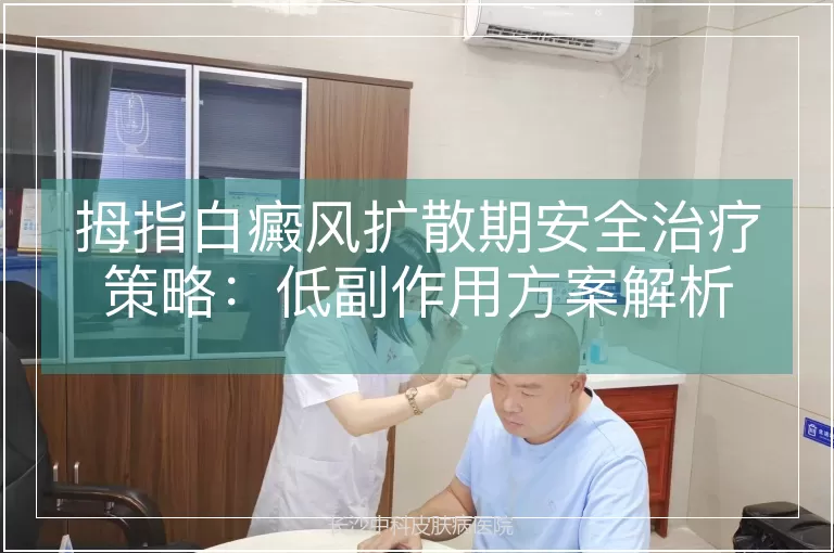 拇指白癜风扩散期安全治疗策略：低副作用方案解析