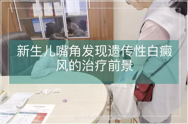 新生儿嘴角发现遗传性白癜风的治疗前景