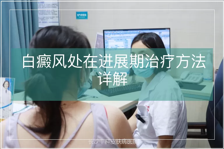 白癜风处在进展期治疗方法详解