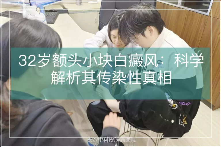 32岁额头小块白癜风：科学解析其传染性真相