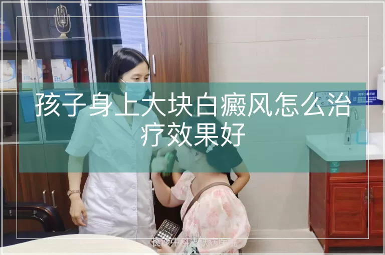 孩子身上大块白癜风怎么治疗效果好