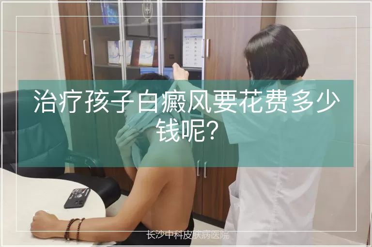 治疗孩子白癜风要花费多少钱呢？